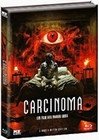 Carcinoma